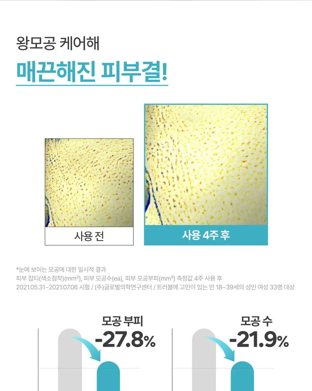 [1+1/깐달걀피부결] 이니스프리 레티놀 시카 흔적 앰플 30ml 더블 기획 상세페이지 13